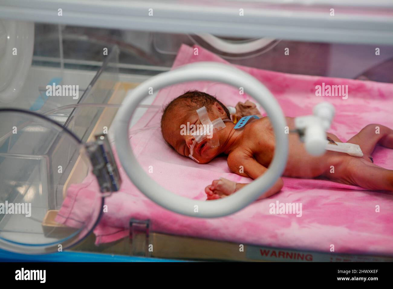 Premature baby in an incubator in the neonatal unit of a hospital