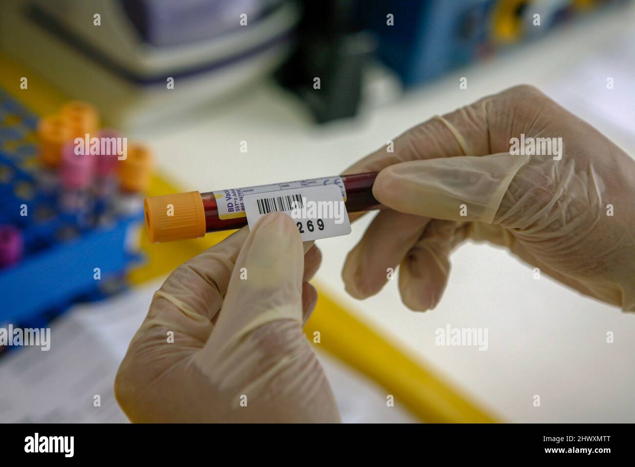 A pathologist labels blood samples in a test tube Stock Photo Alamy