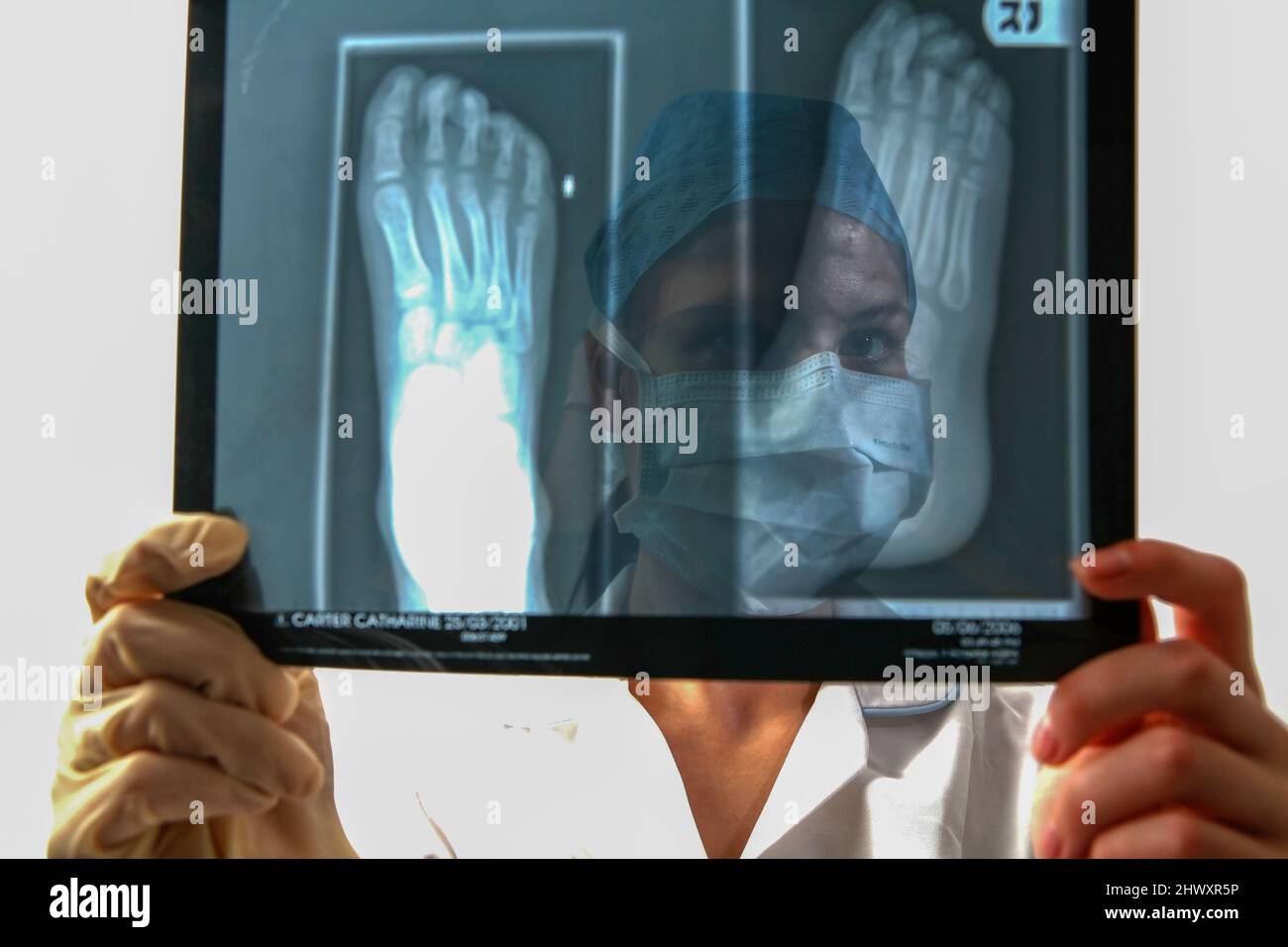 A young surgeon examins an X-Ray of a foot. (MODEL RELEASED) Stock Photo