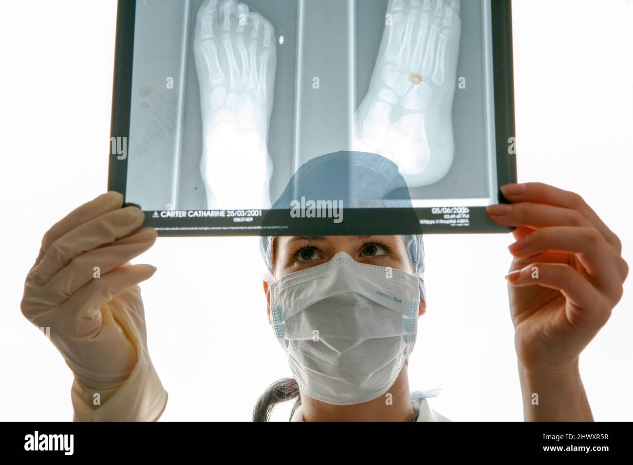 A young surgeon examins an X-Ray of a foot. (MODEL RELEASED) Stock Photo
