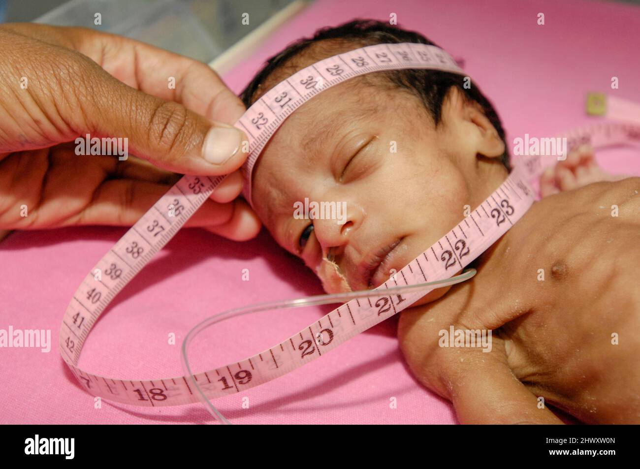 A neonatal nurse measure's the head of a premature baby to make record of growth progress, as part of her examination. Stock Photo