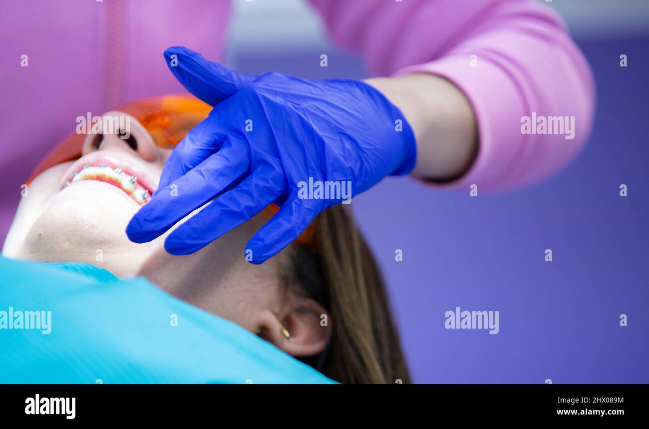 Placa dental hires stock photography and images Alamy