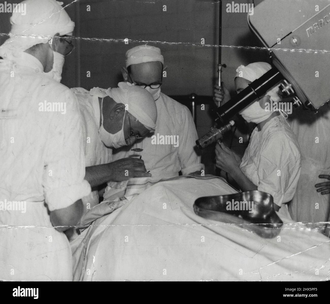 Magnifying Spectacles. The operation was extremely delicate and the surgeon wore this set of magnifying spectacles. January 8, 1950. Stock Photo
