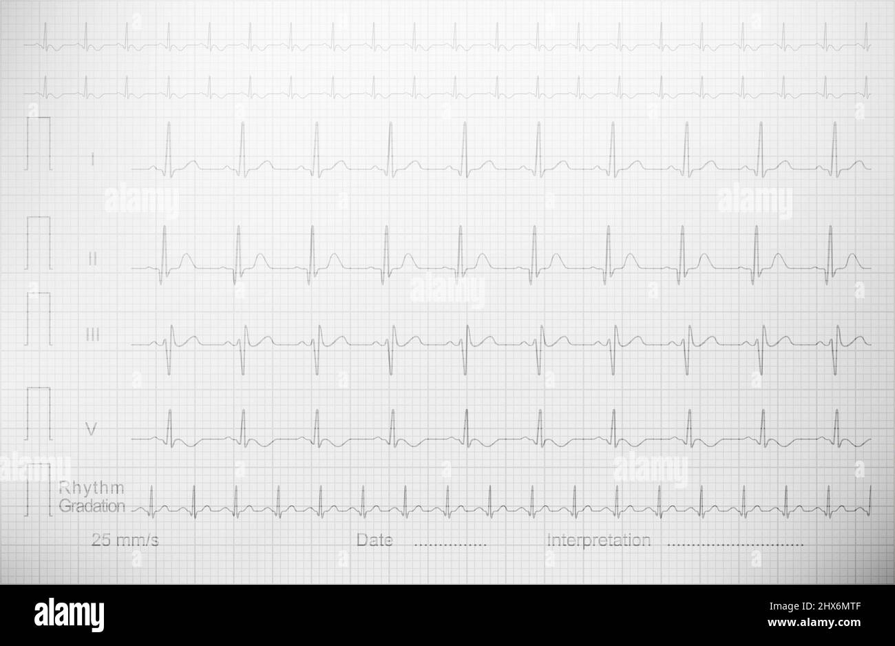 Cardiogram with lined paper as a background for a medical publication, annual report, etc. echocardiogram   ultrasound cardiogram ultrasonic cardiogra Stock Photo