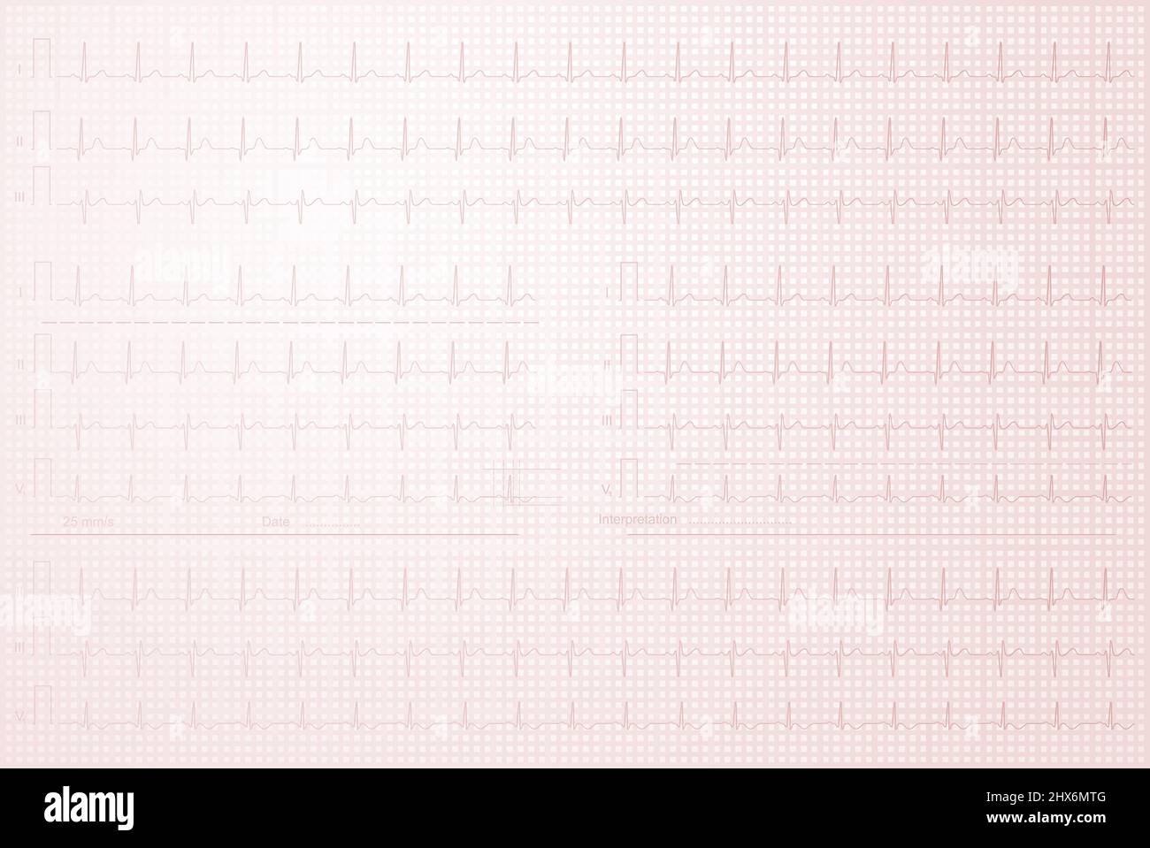 Cardiogram with lined paper as background Stock Photo