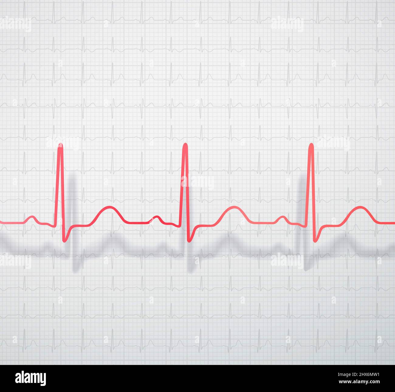 Spatially located cardiogram on the background of medical ecg paper Stock Photo