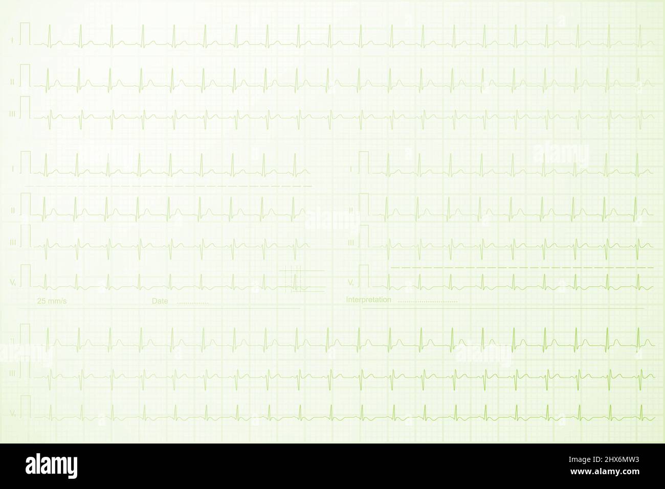 Cardiogram lines on the paper background illustration Stock Photo