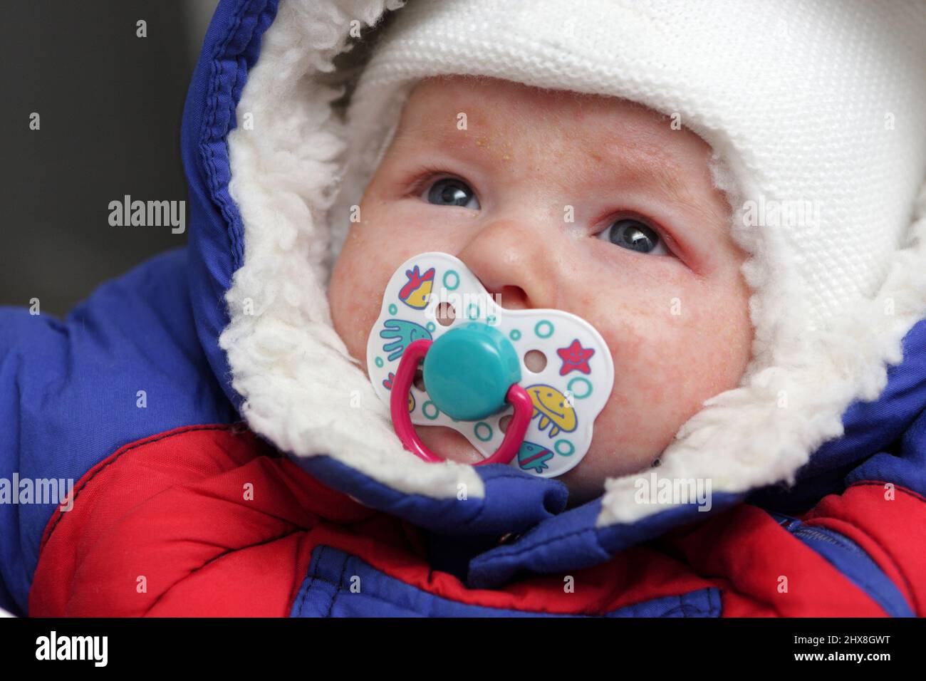 The infant has eczema on his face Stock Photo - Alamy