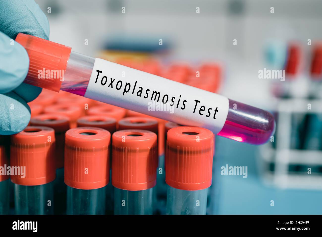 Test tube with blood sample in doctor's hand in laboratory for