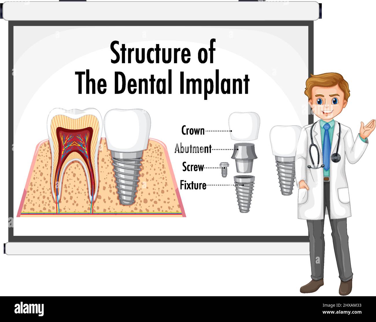 Infographic of human in structure of the dental implant illustration