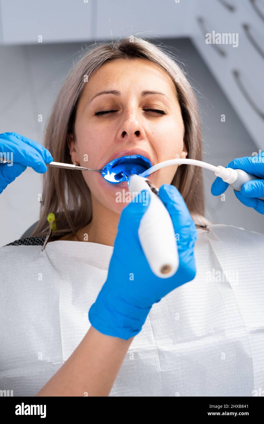 Female dentist treats the cavity of the teeth in blue gloves. Treatment