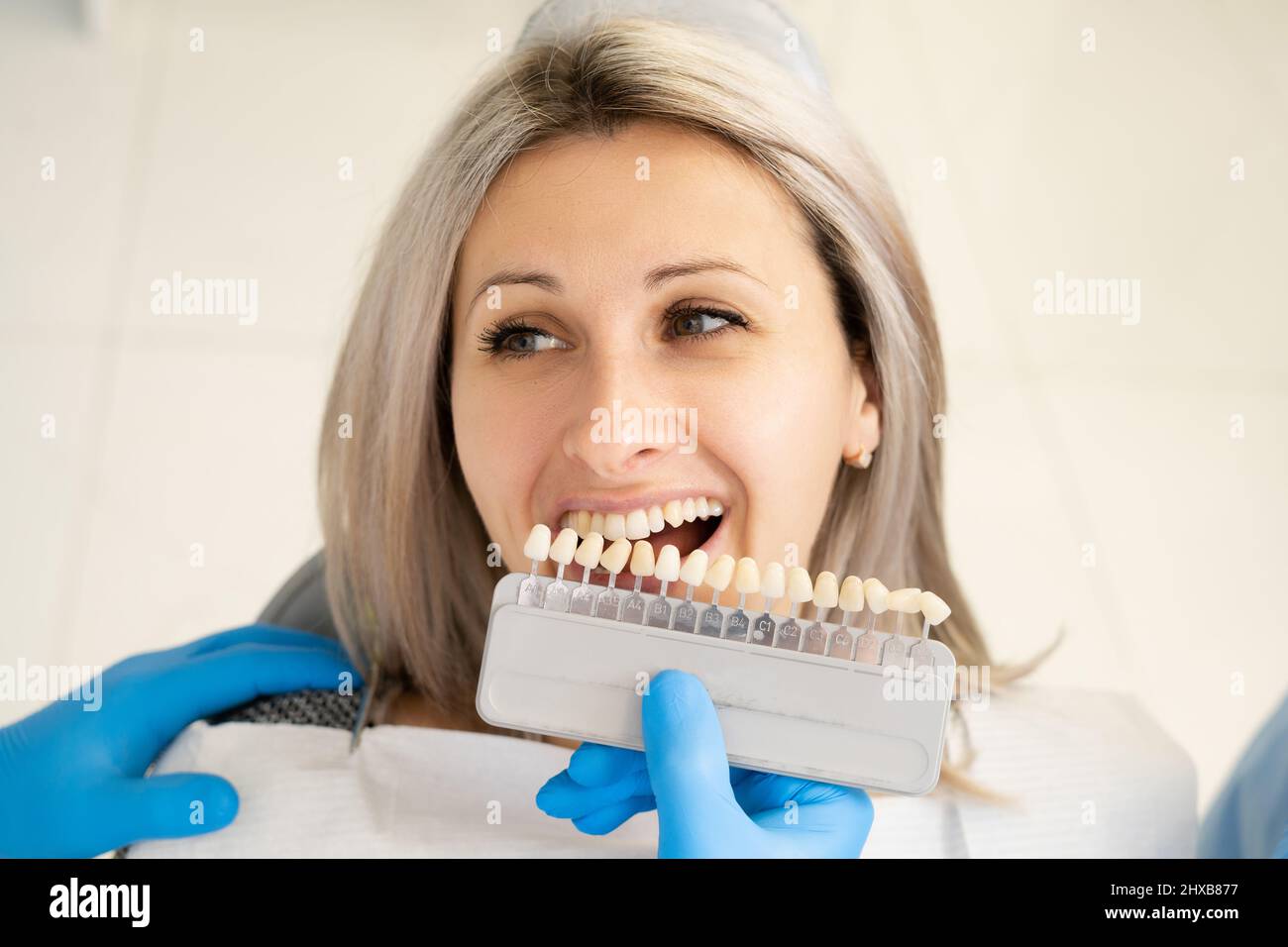 Tooth color palette. Dentist orthodontist dentist chooses the color of the patient's teeth for