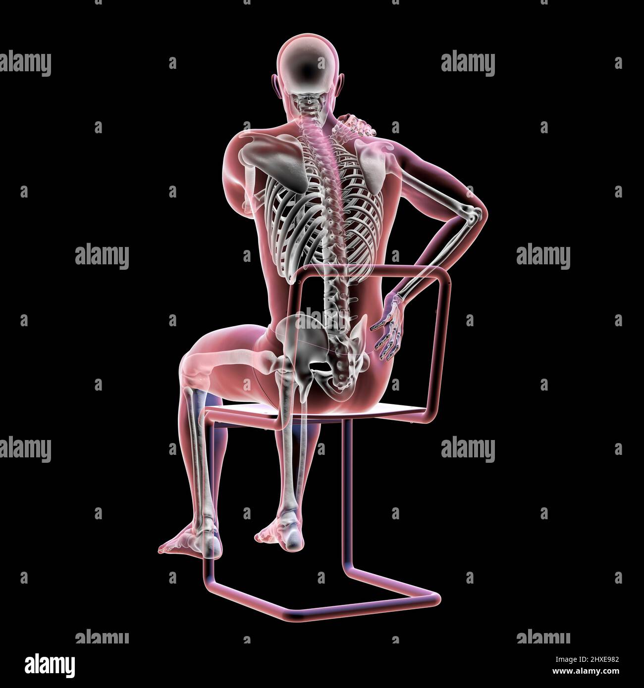 Back pain, conceptual illustration Stock Photo - Alamy
