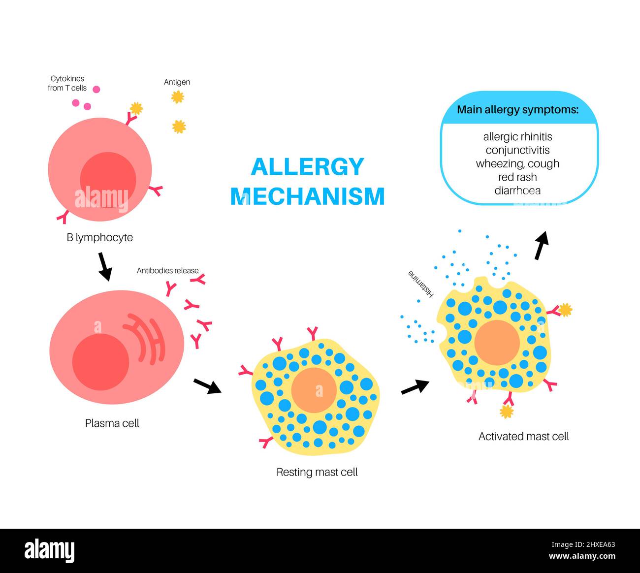 Allergy mechanism, illustration Stock Photo