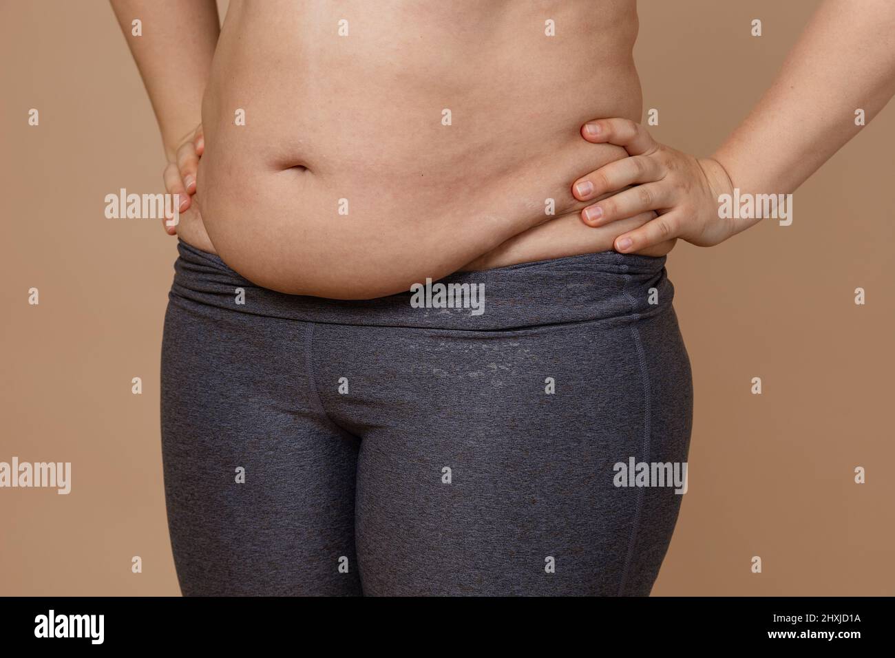 Front view of overweighted thick belly of woman wearing leggings