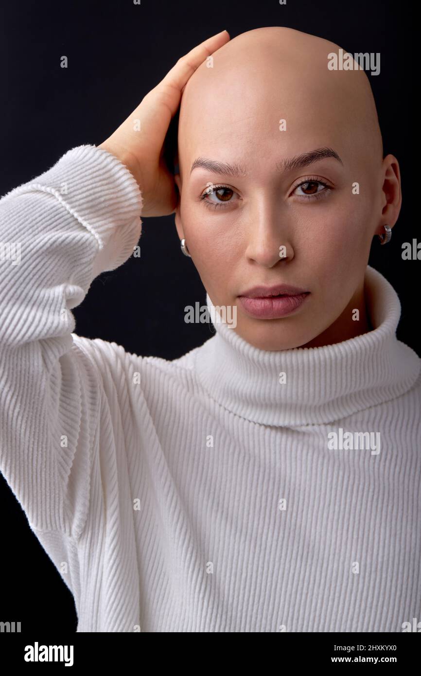bald woman on black studio background, looks at camera, confident. she feels awkward due to falling hair. concept of oncology and effects of chemother Stock Photo