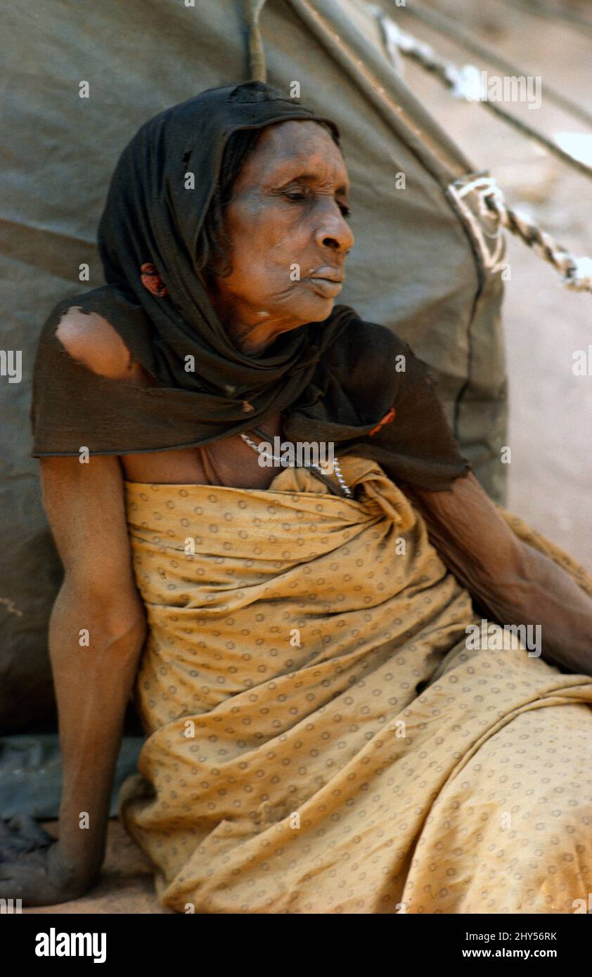 El Geneina Sudan Woman Suffering from Leprosy Stock Photo