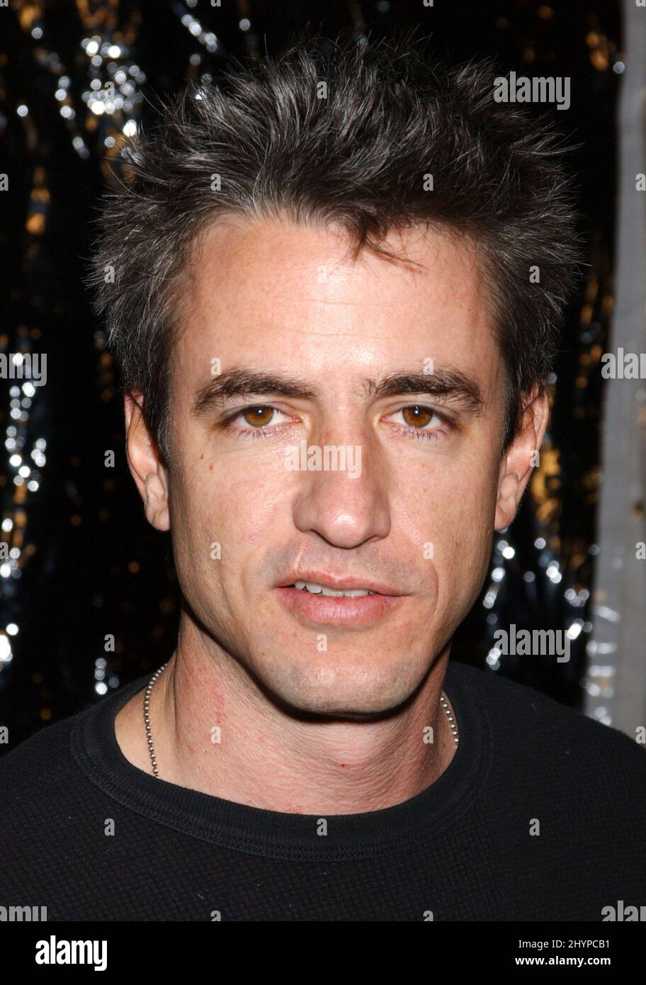 dermot mulroney lip scar