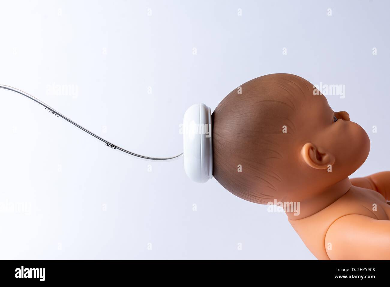 Vacuum delivery extraction pump, to assist delivery of a baby using a