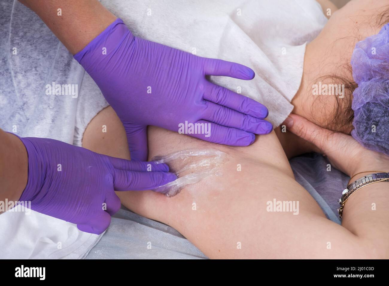 Sugaring hair removal concept. Process depilation of underarm girl with sugar paste in spa salon Stock Photo