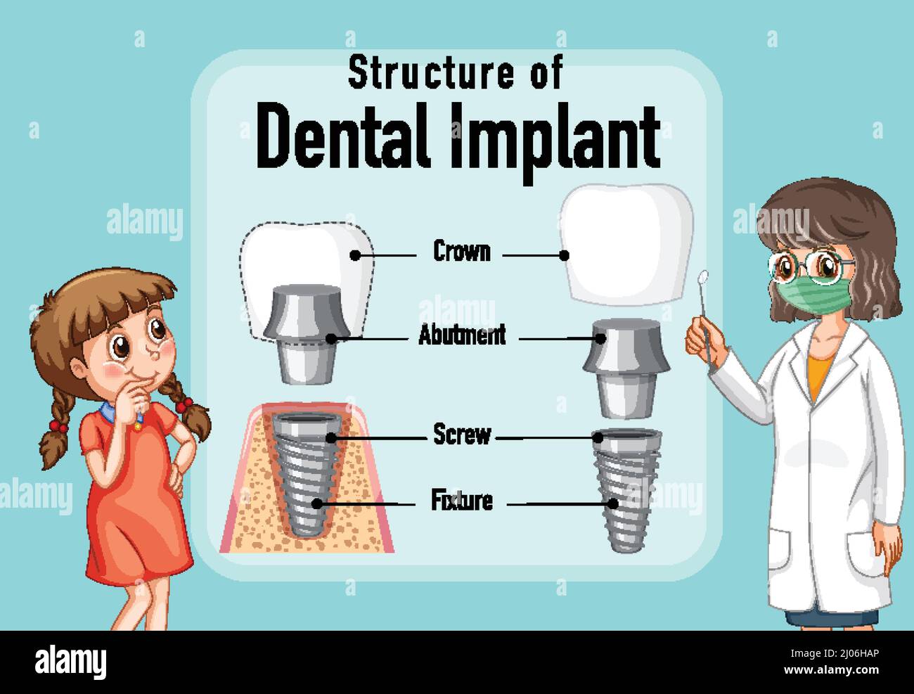 Infographic of human in structure of the dental implant illustration