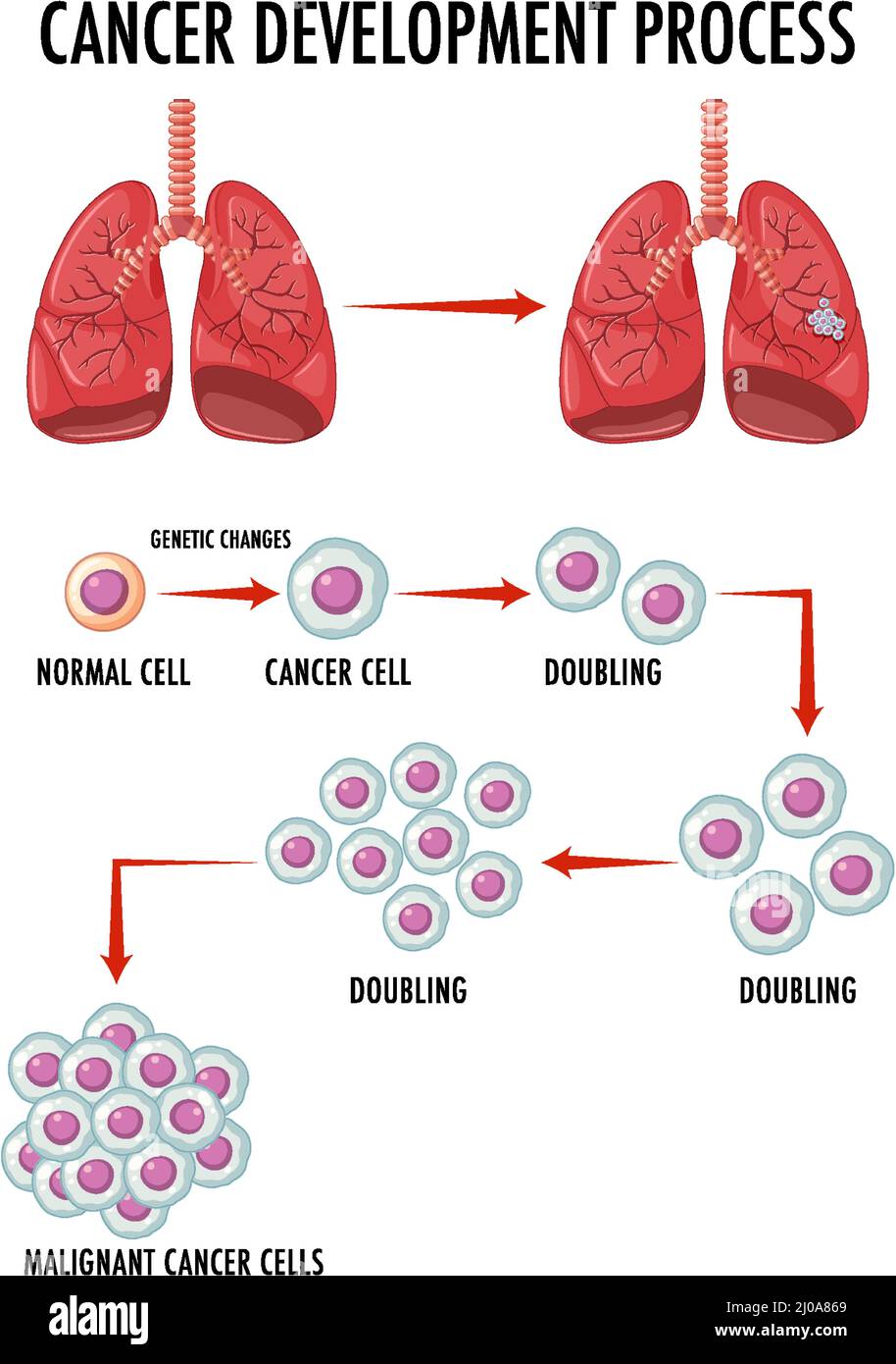 Diagram showing cancer development process illustration Stock Vector ...