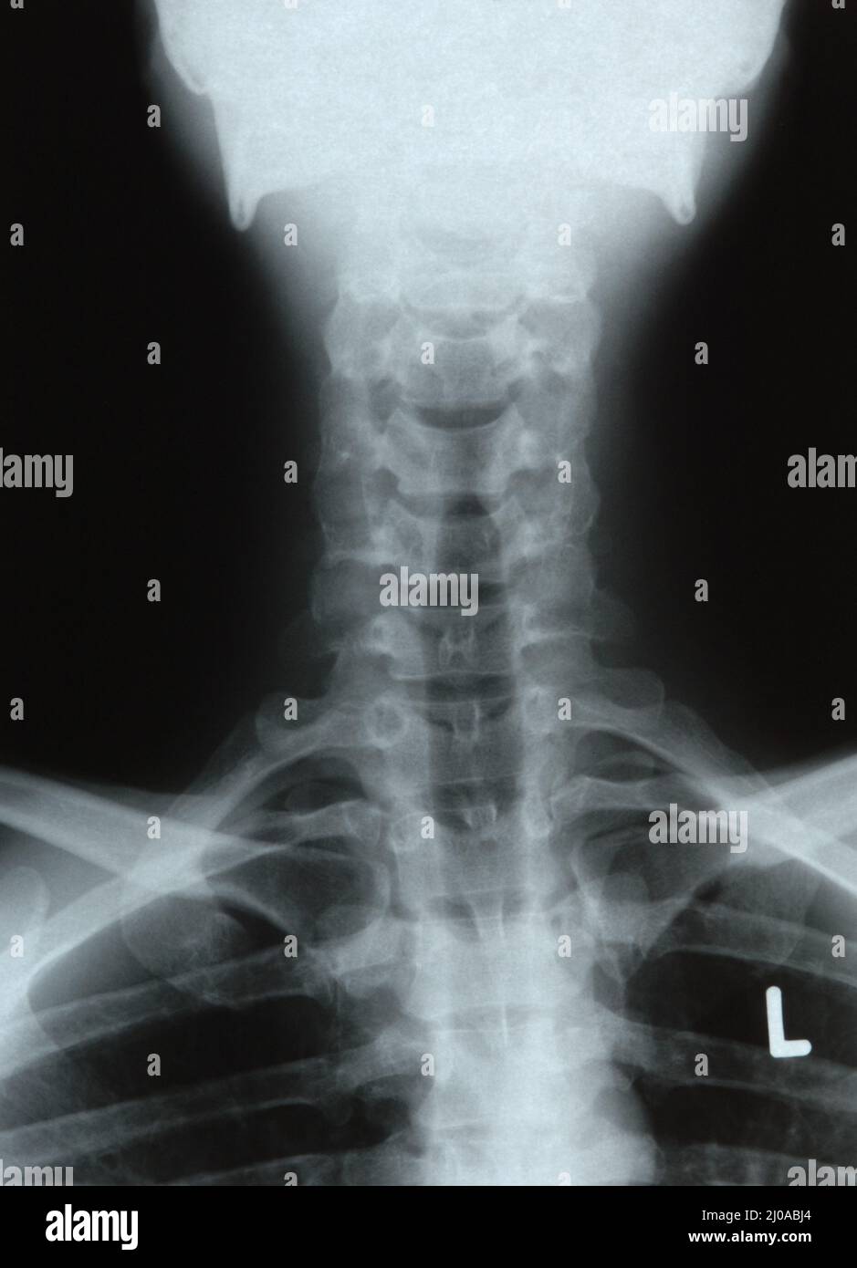 Spine cervical hi-res stock photography and images - Alamy