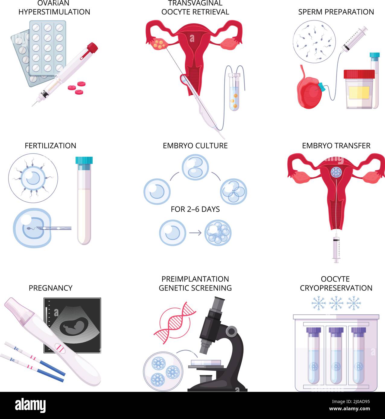 Isolated flat in vitro fertilization IVF icon set with fertilization ...
