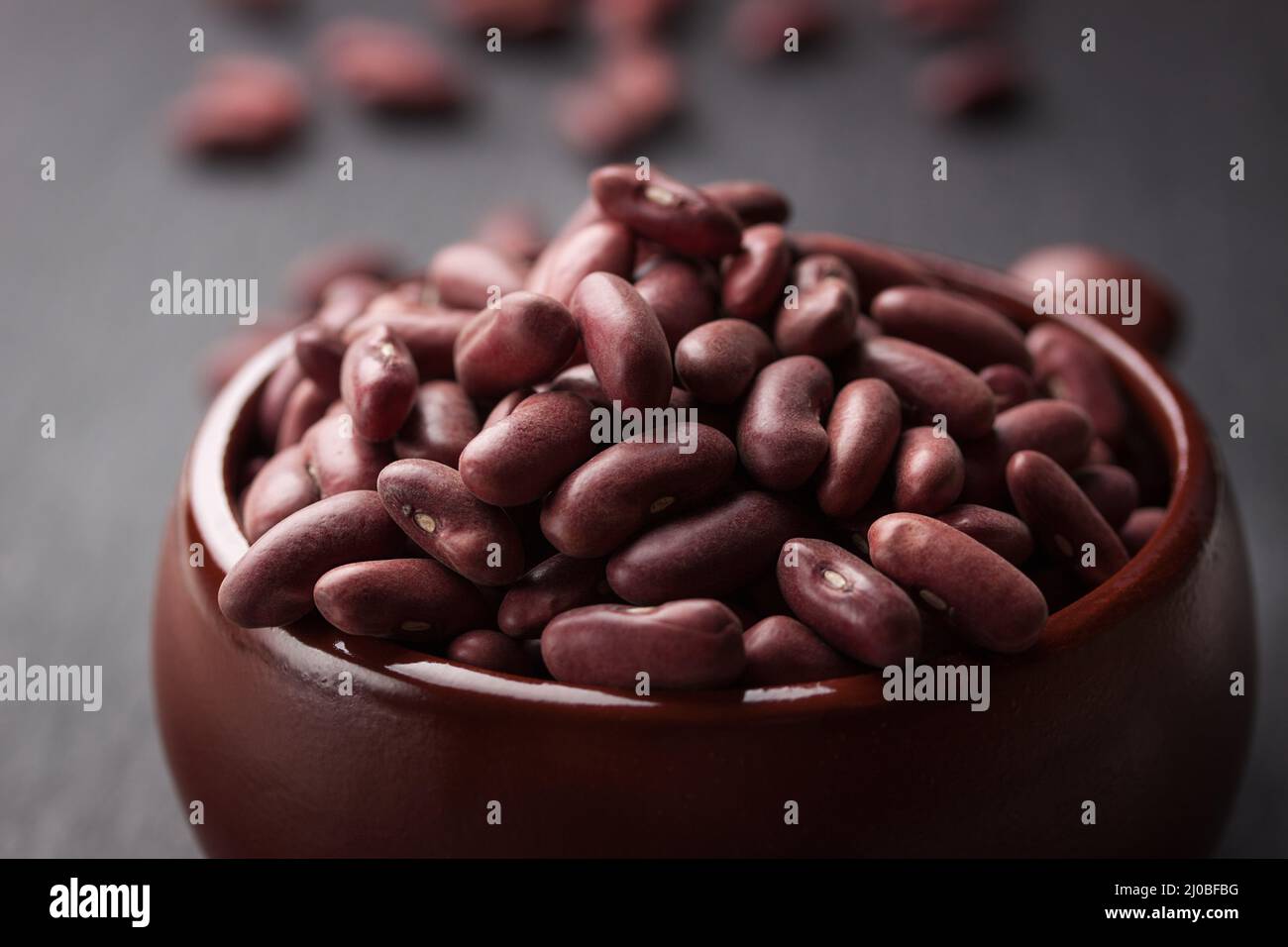 Kidney stone hires stock photography and images Alamy