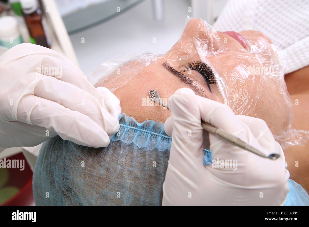 Professional cleansing of acne in a beauty salon. Stock Photo