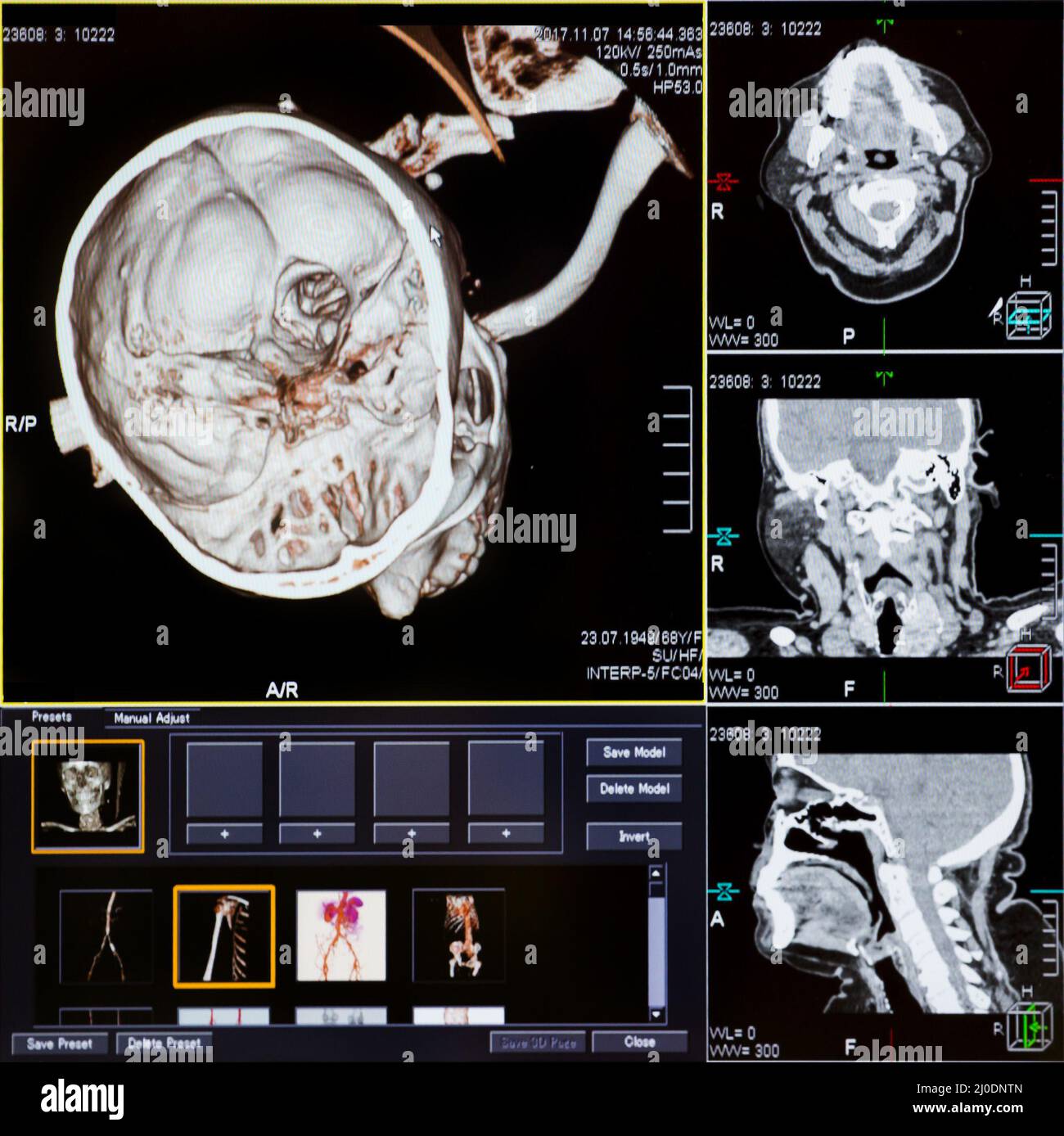 CT scans of human head Stock Photo Alamy