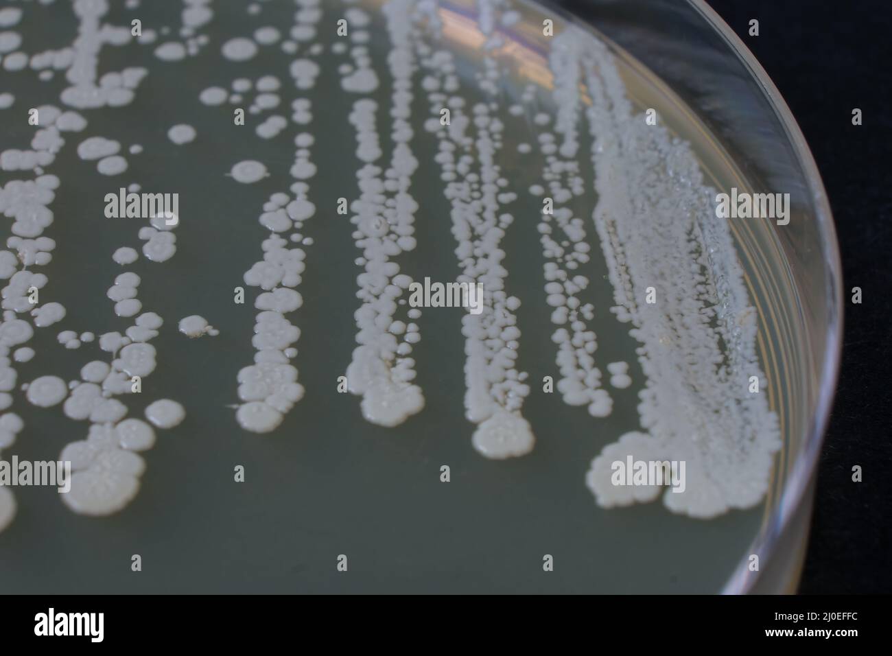 closeup photo of growth of bacteria clolonies on agar media Stock Photo