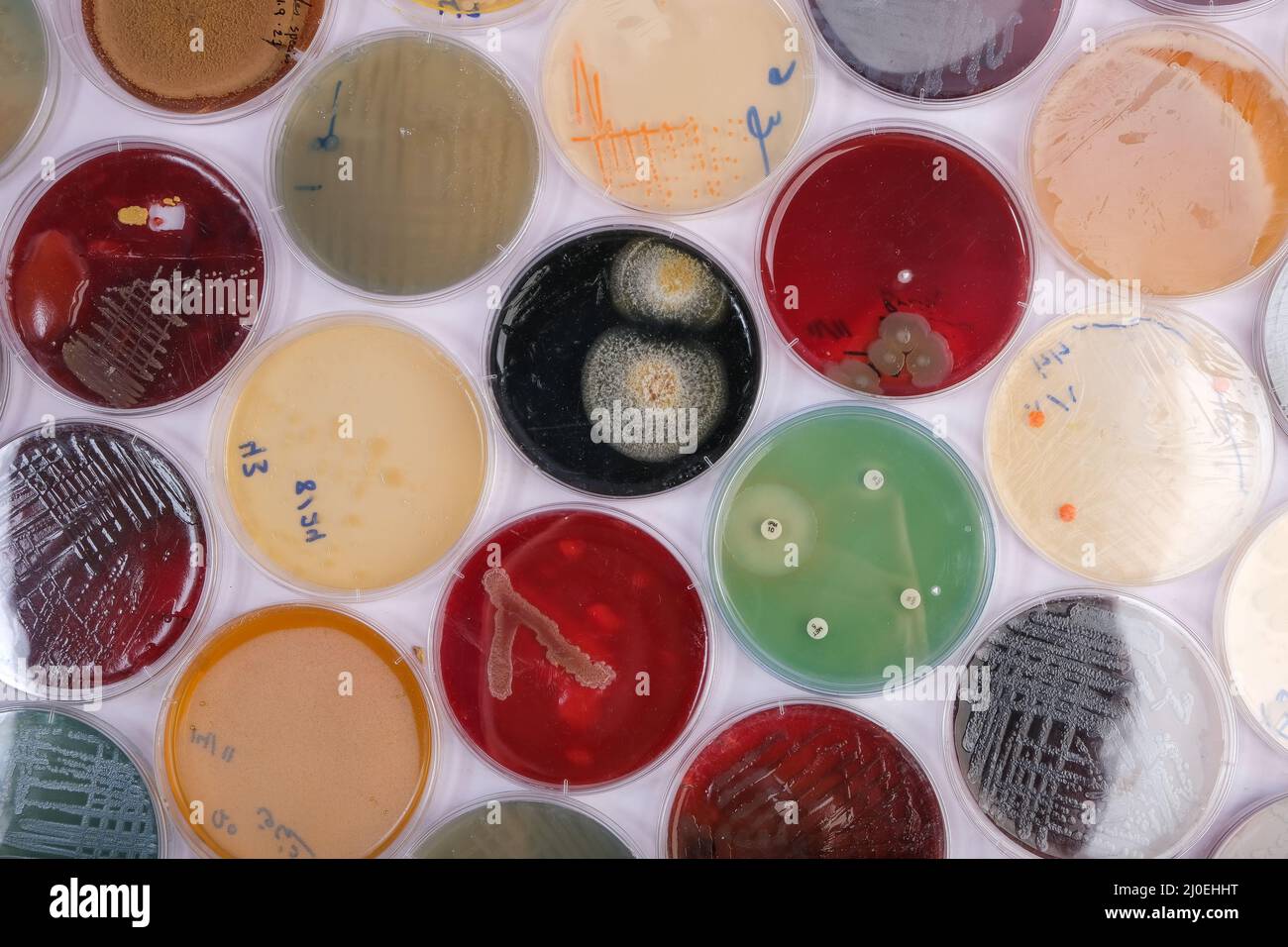 collection of culture plates contain growth of on