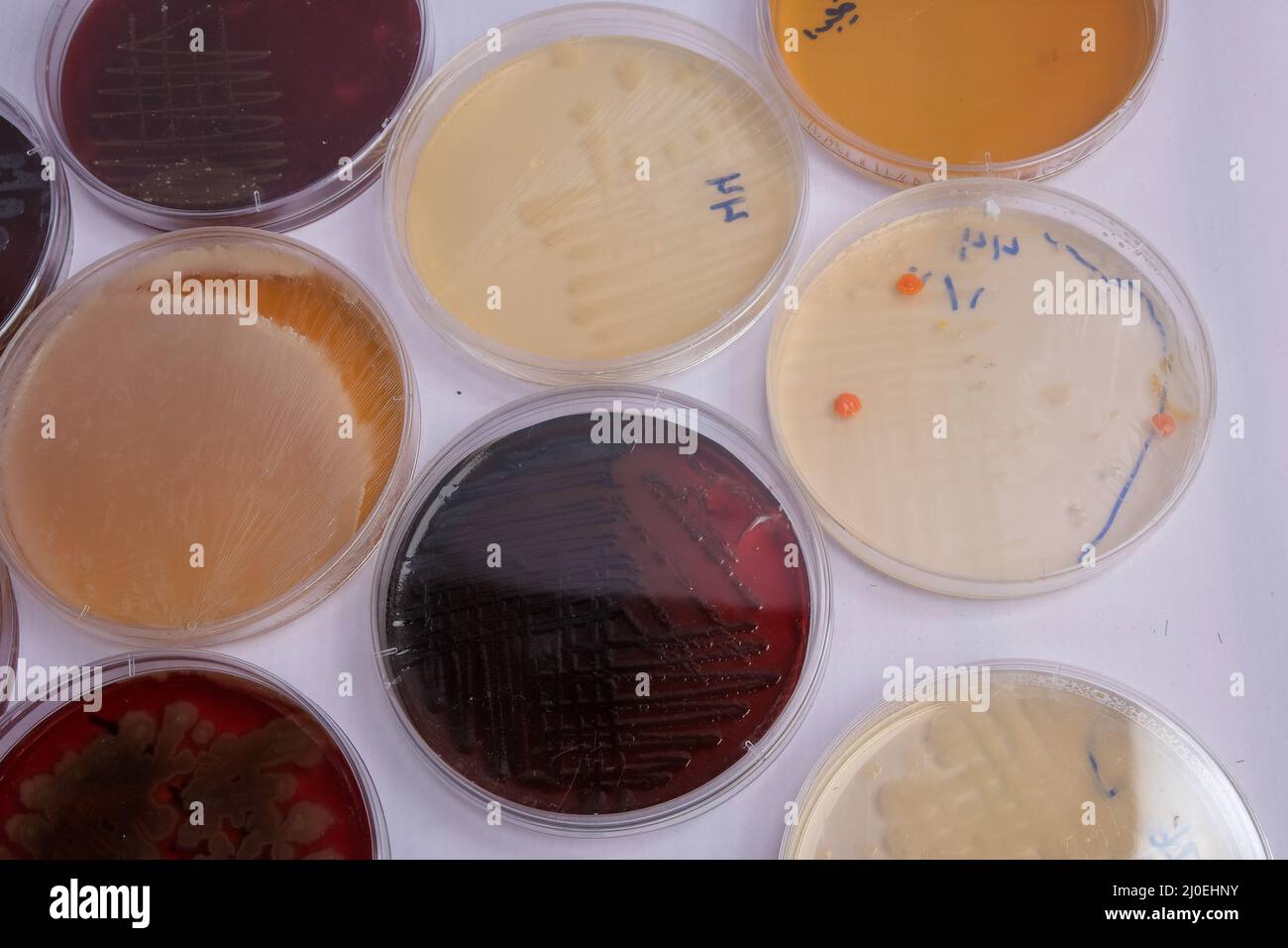 collection of culture plates contain growth of microorganisms on different agar media Stock Photo