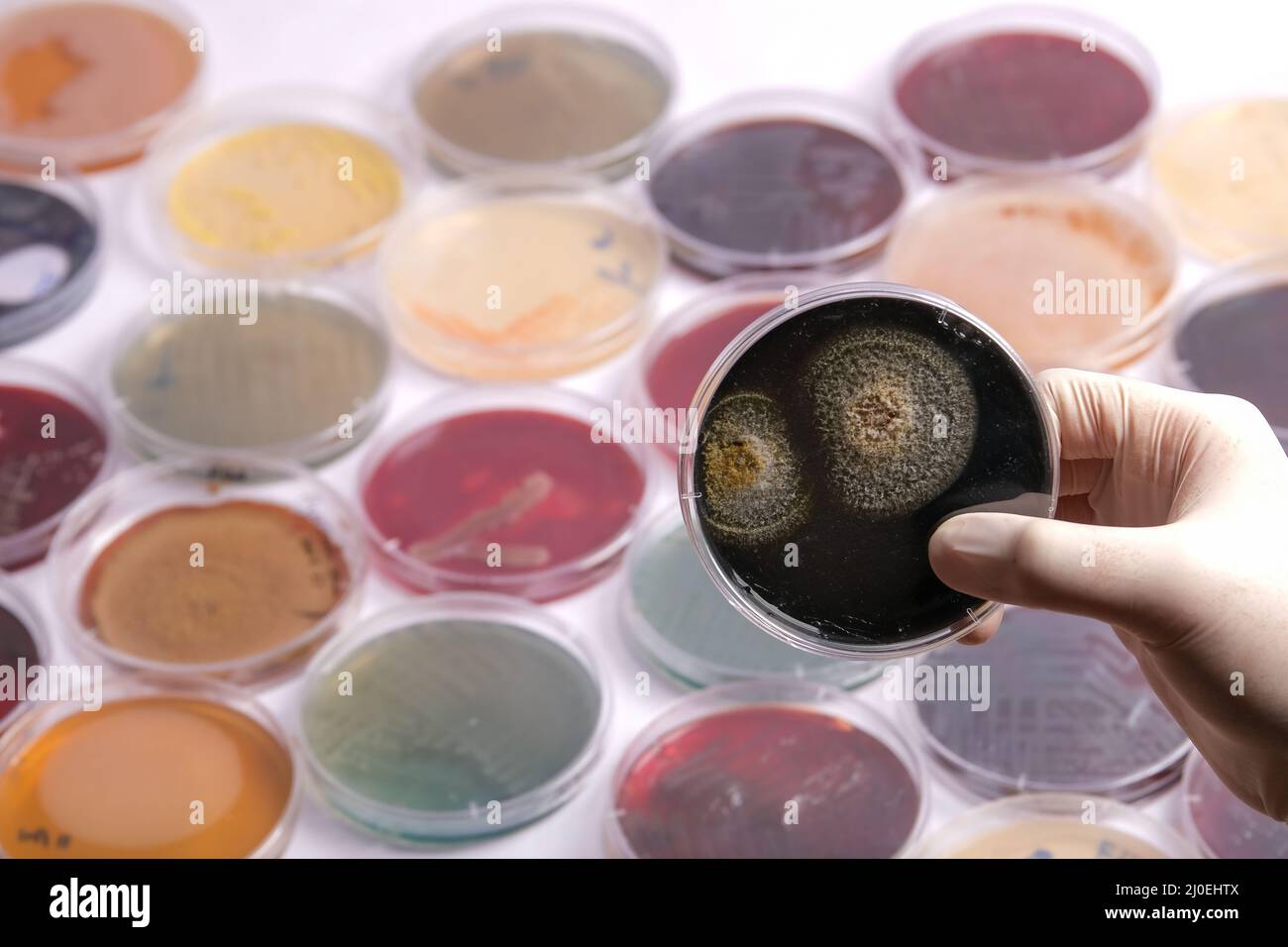 collection of culture plates contain growth of on