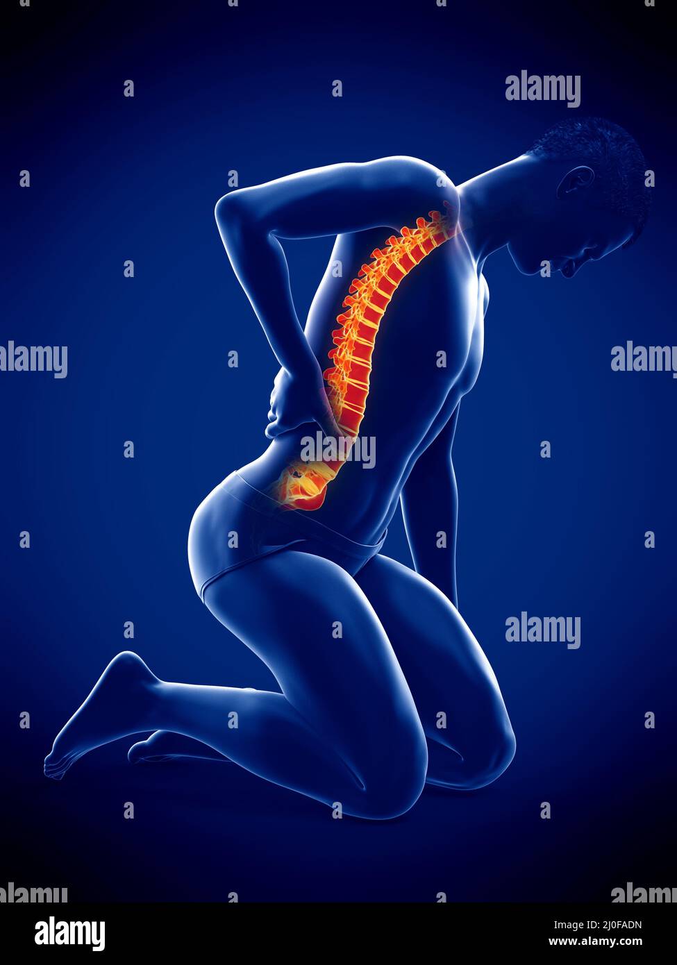 Man with acute back pain, illustration Stock Photo - Alamy