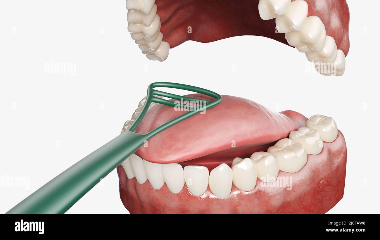Tongue cleaning, illustration Stock Photo Alamy