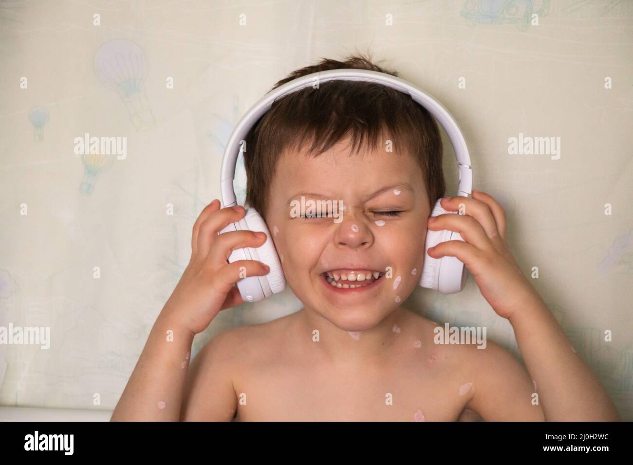 Red rash ear hires stock photography and images Alamy