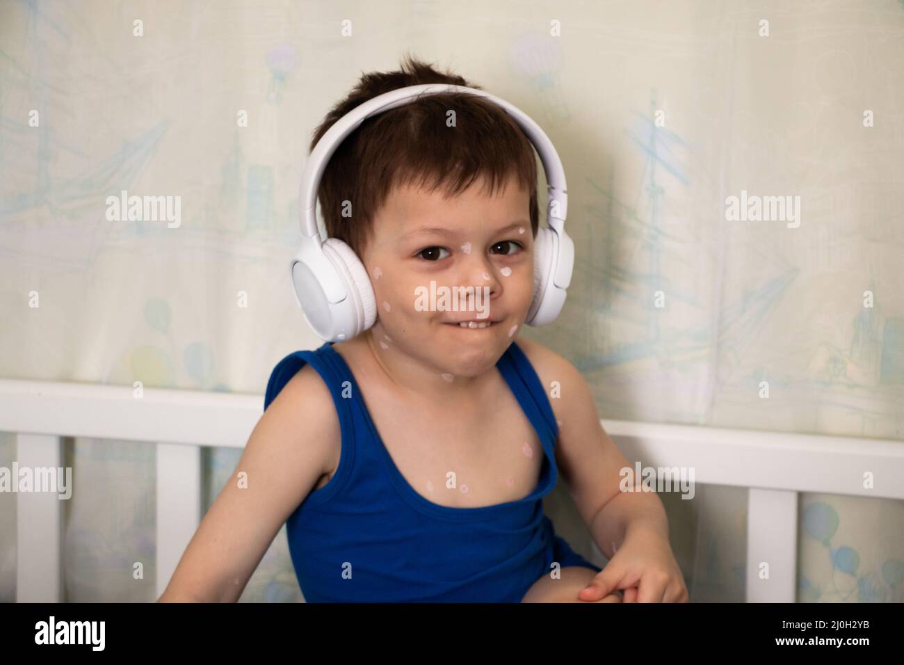 Red rash ear hires stock photography and images Alamy