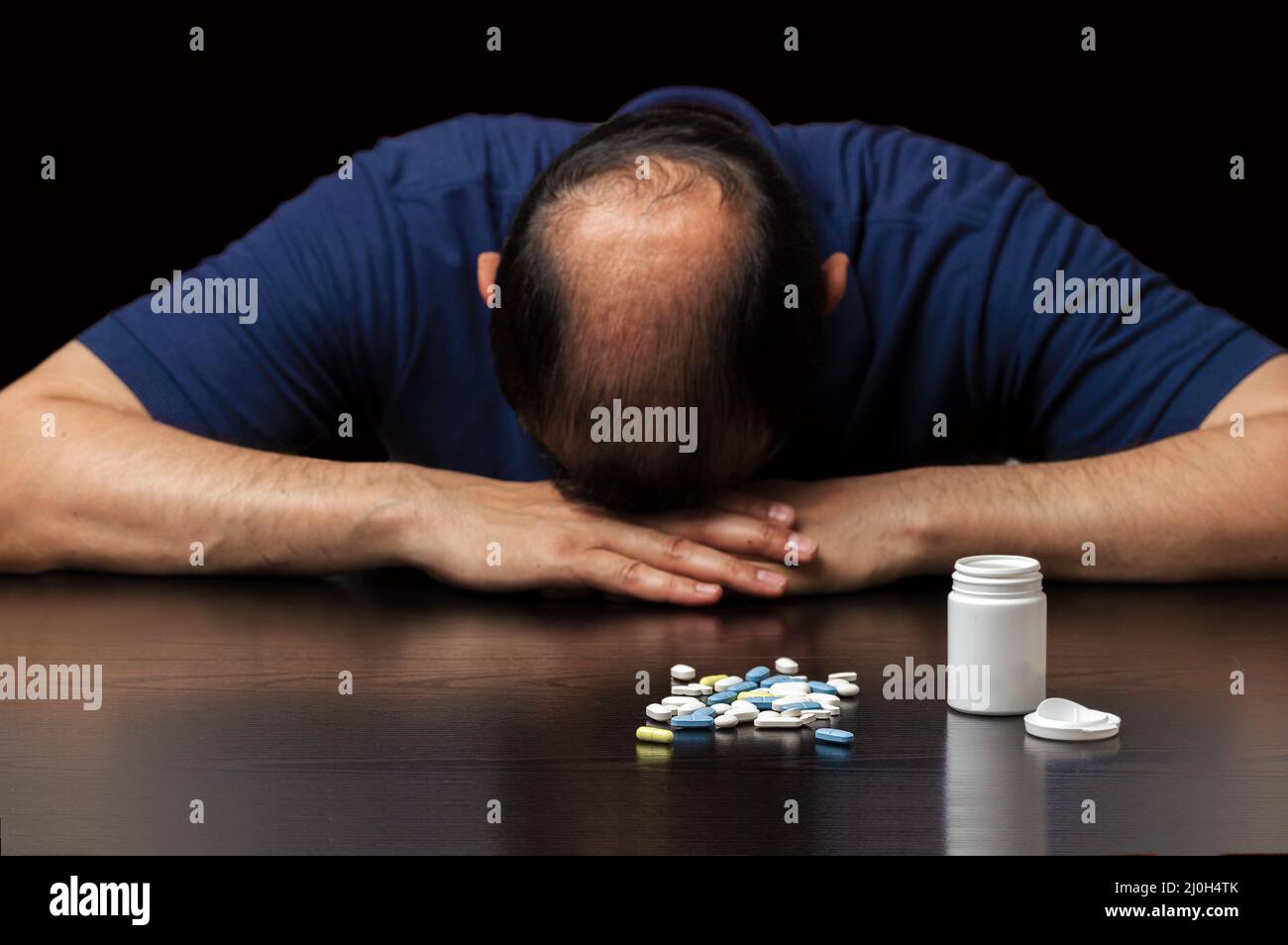 Close up of a bald man depressed by the ineffectiveness of pills to prevent hair loss on a dark background Stock Photo
