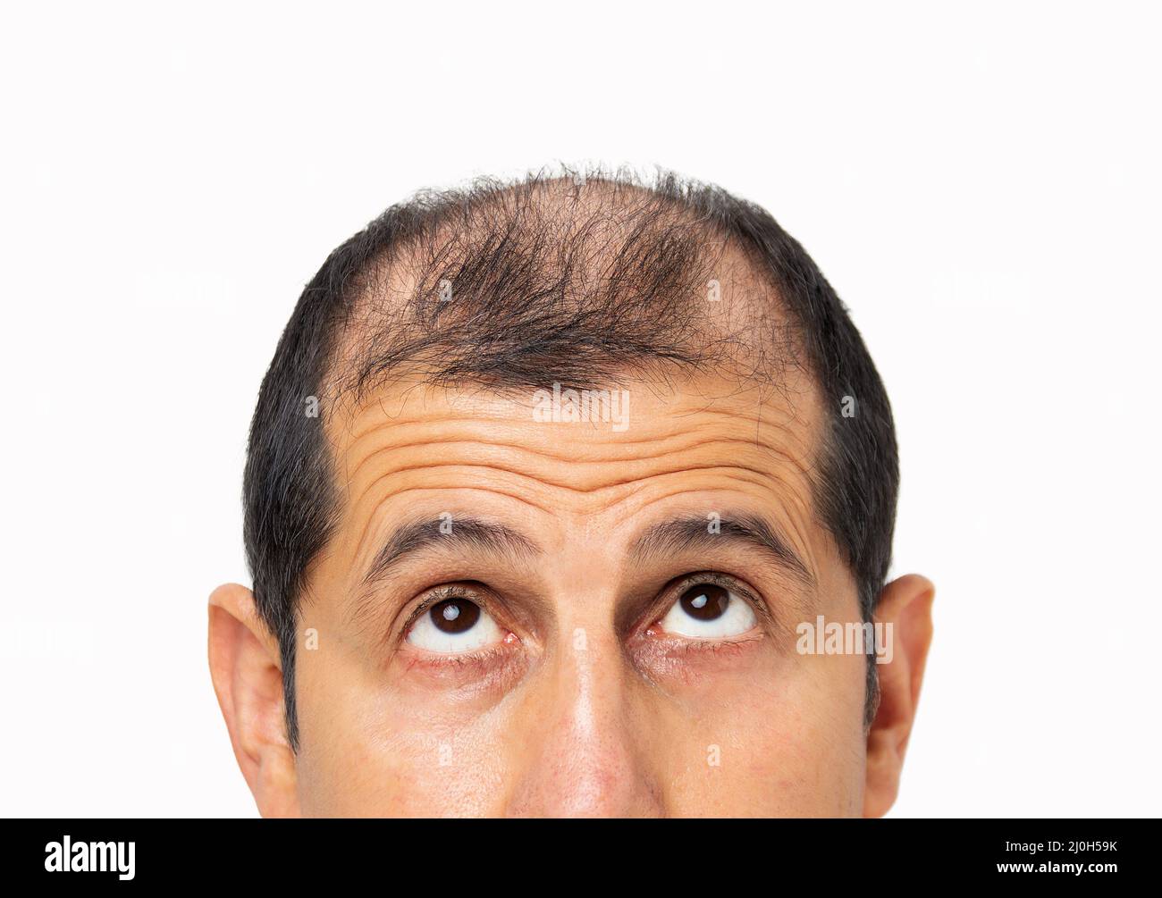 Young bald man  over white isolated background looking up sad, upset, unhappy and depressed. Stock Photo