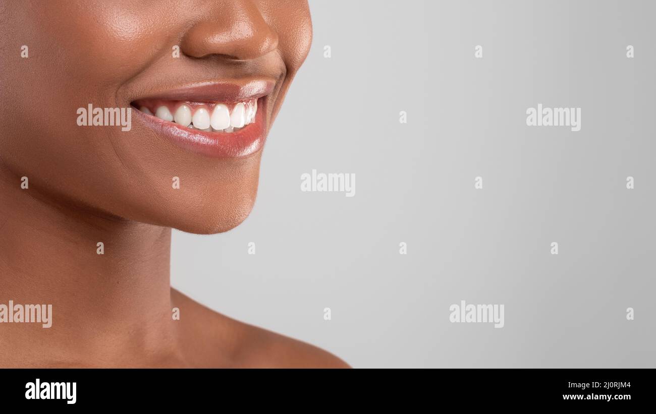 Dental Advertisement. Closeup Shot Of Beautiful Smile Of Young Black Woman Stock Photo