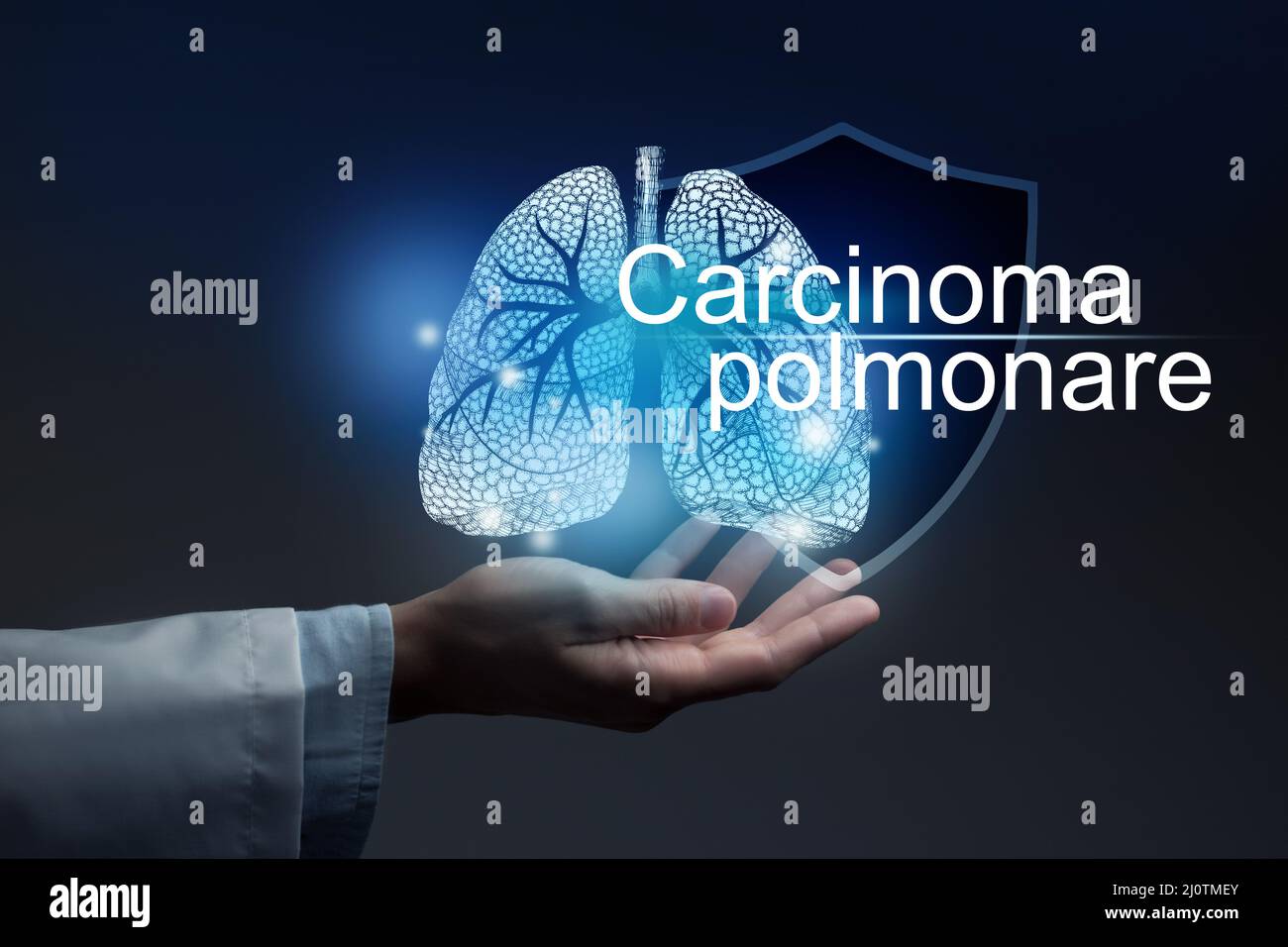 Medical banner Carcinoma with italian translation Carcinoma polmonare on blue background with large copy space Stock Photo