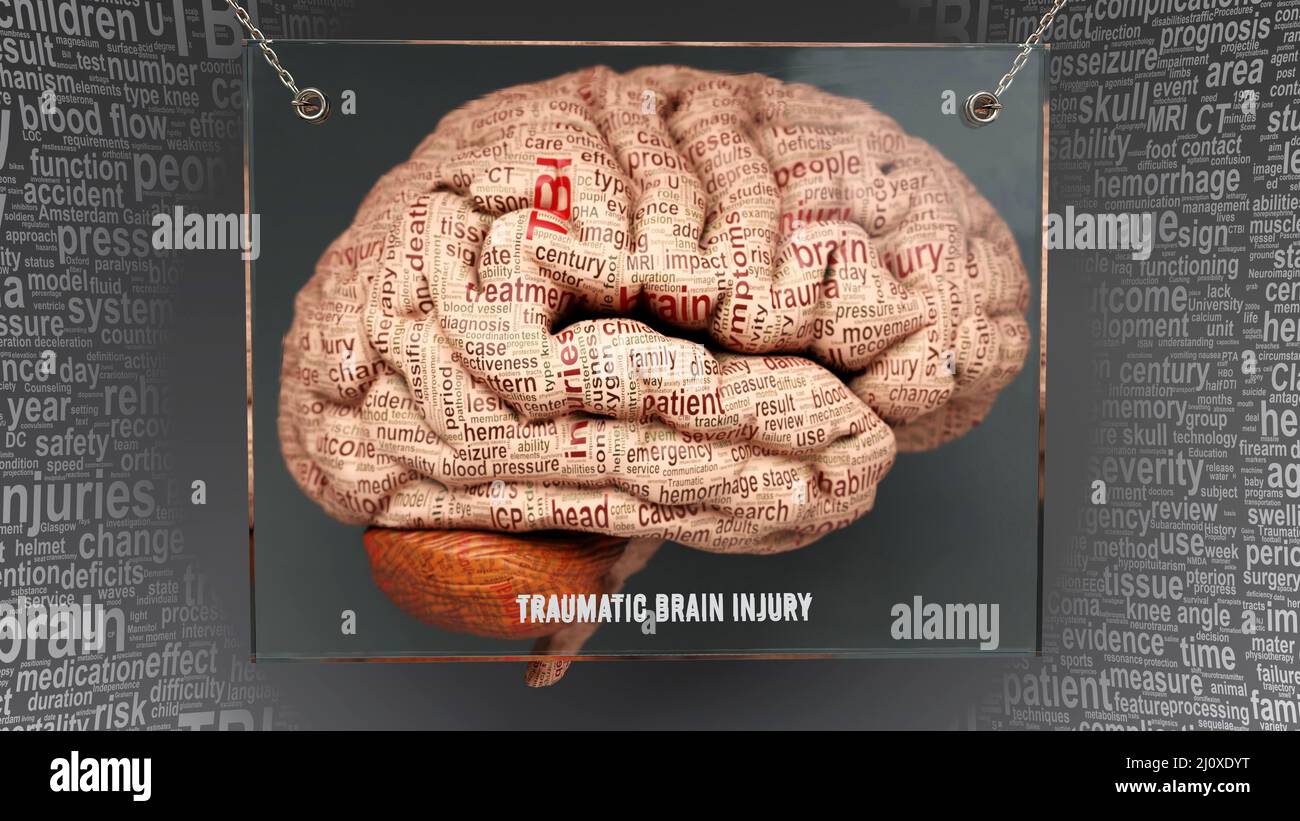 Traumatic brain injury anatomy - its causes and effects projected on a human brain revealing Traumatic brain injury complexity and relation to human m Stock Photo
