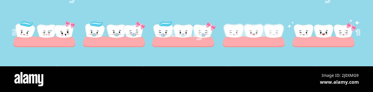 Tooth crooked, with dental braces stage, mouth guard in gym cute kawaii ...