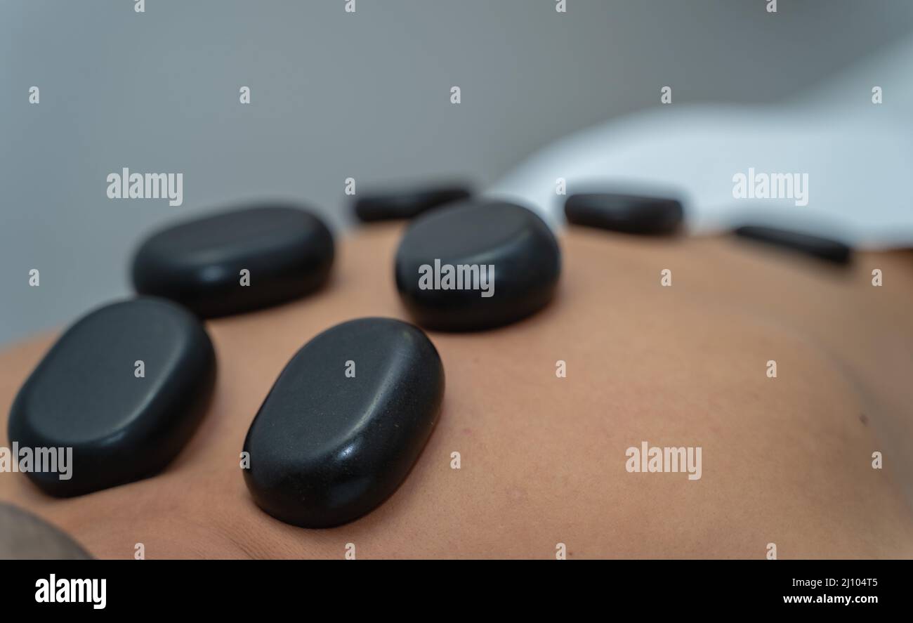 Massage cupping therapy Stock Photo Alamy
