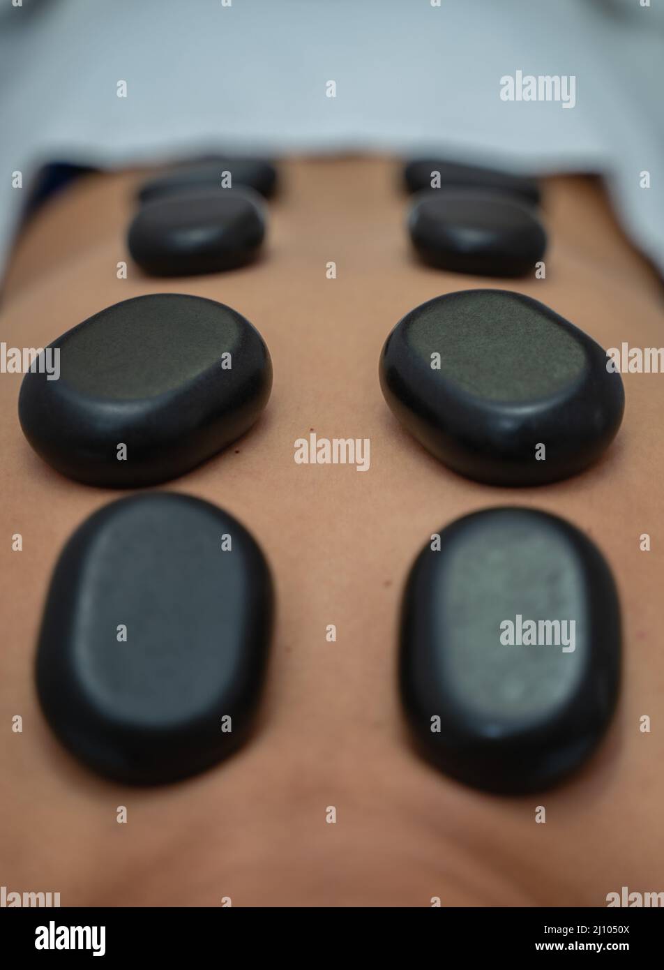 Massage cupping therapy Stock Photo Alamy