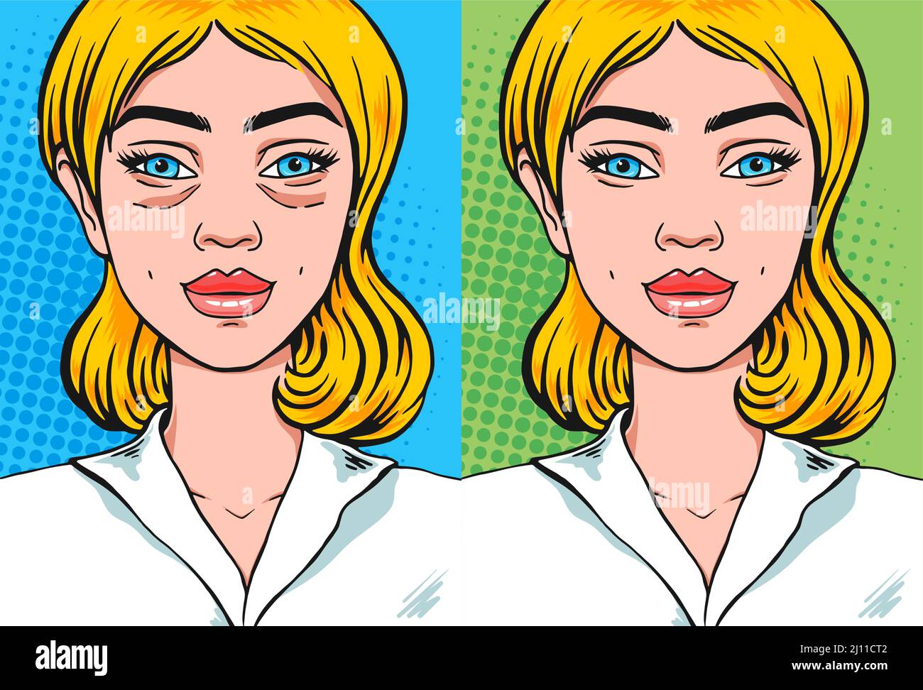 Blepharoplasty woman face before and after. Under eye lifting facial procedure side by side comparison, vector illustration in pop art comics style Stock Vector