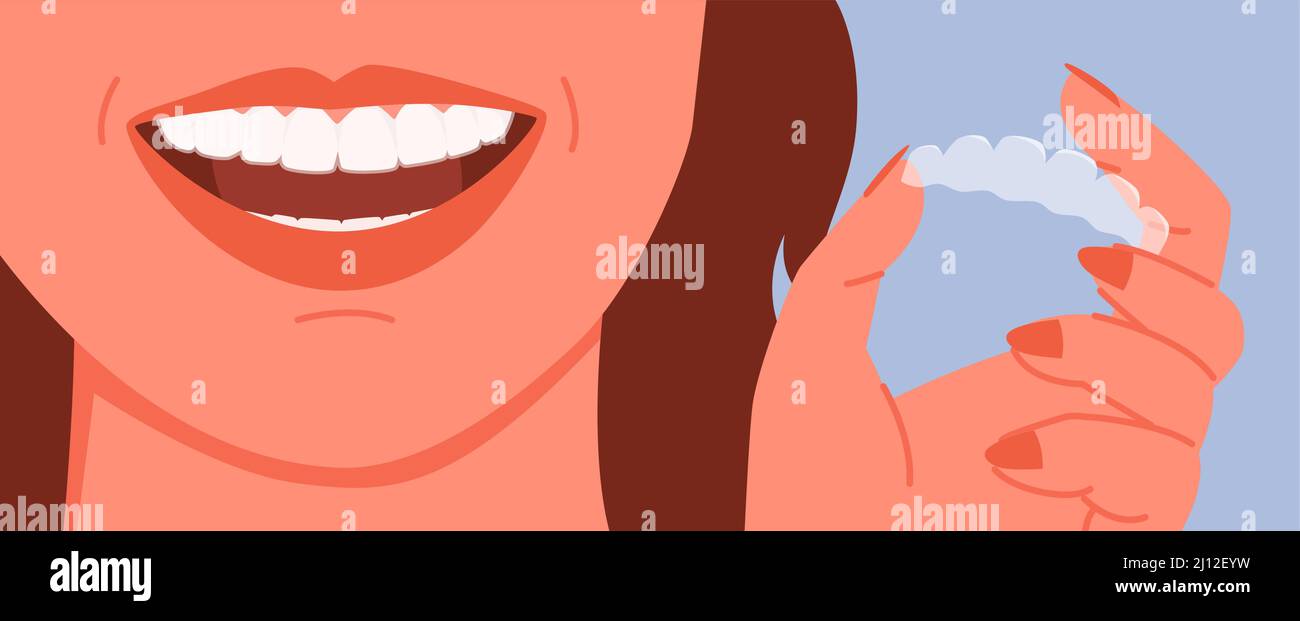 Cartoon woman holding invisalign transparent braces with smile, orthodontic denture banner template background. Invisible dental braces correction for Stock Vector