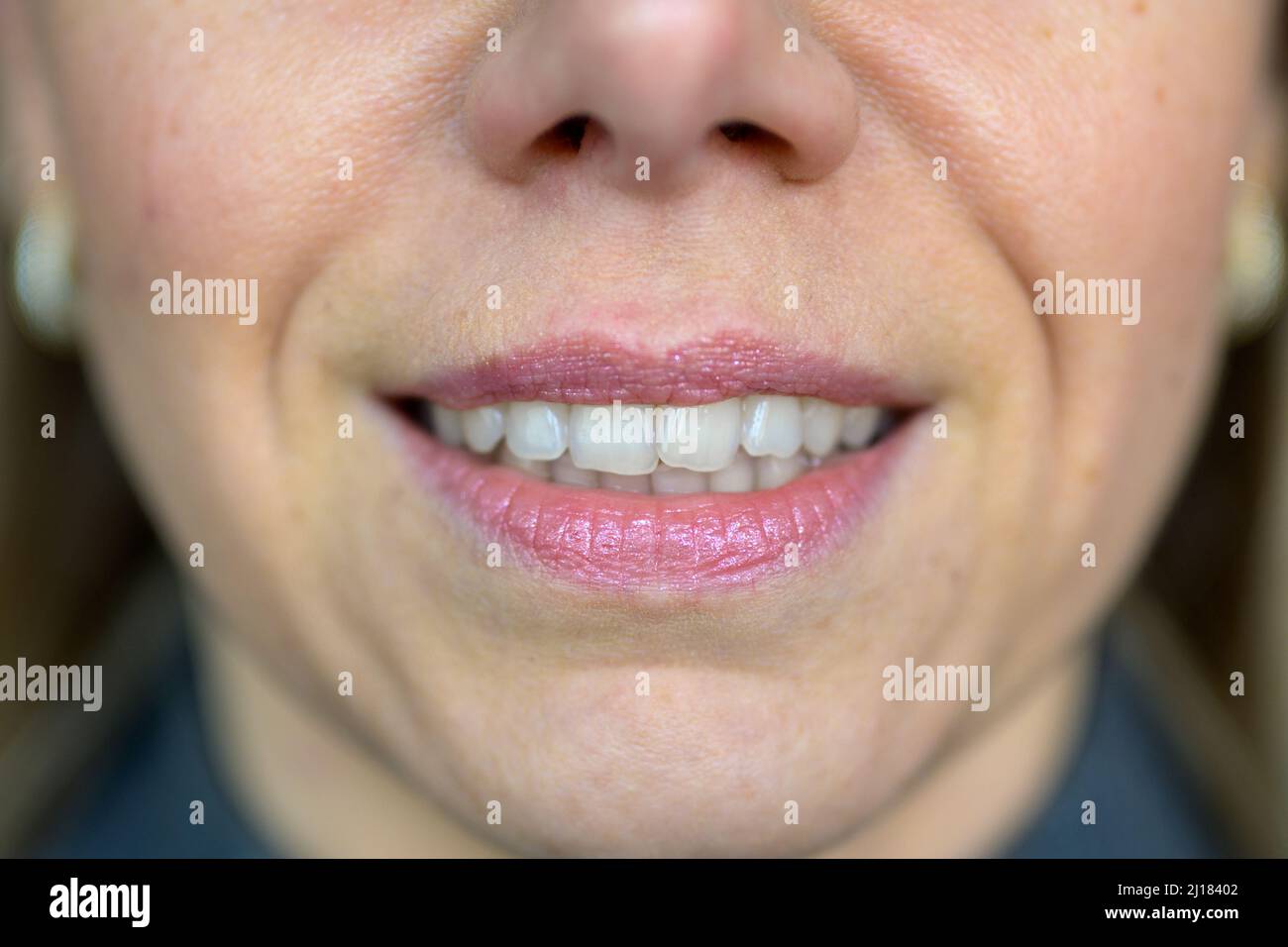 Woman Nostrils Hi res Stock Photography And Images Alamy woman-nostrils-hi-res-stock-photography-and-images-alamy